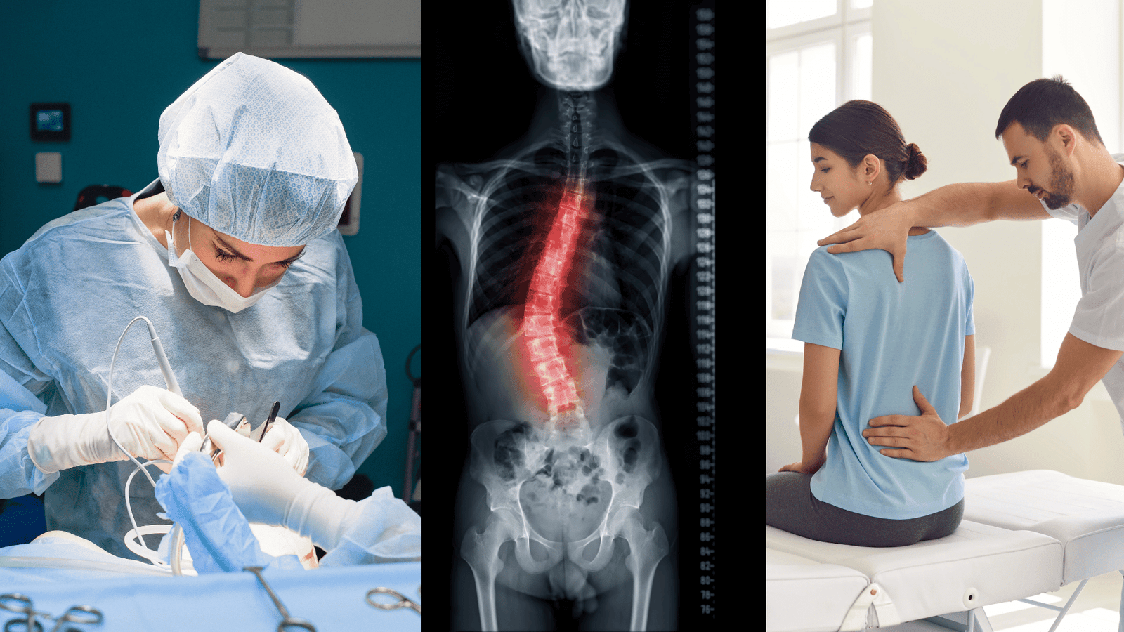 Spine surgery vs. physiotherapy comparison for back pain.