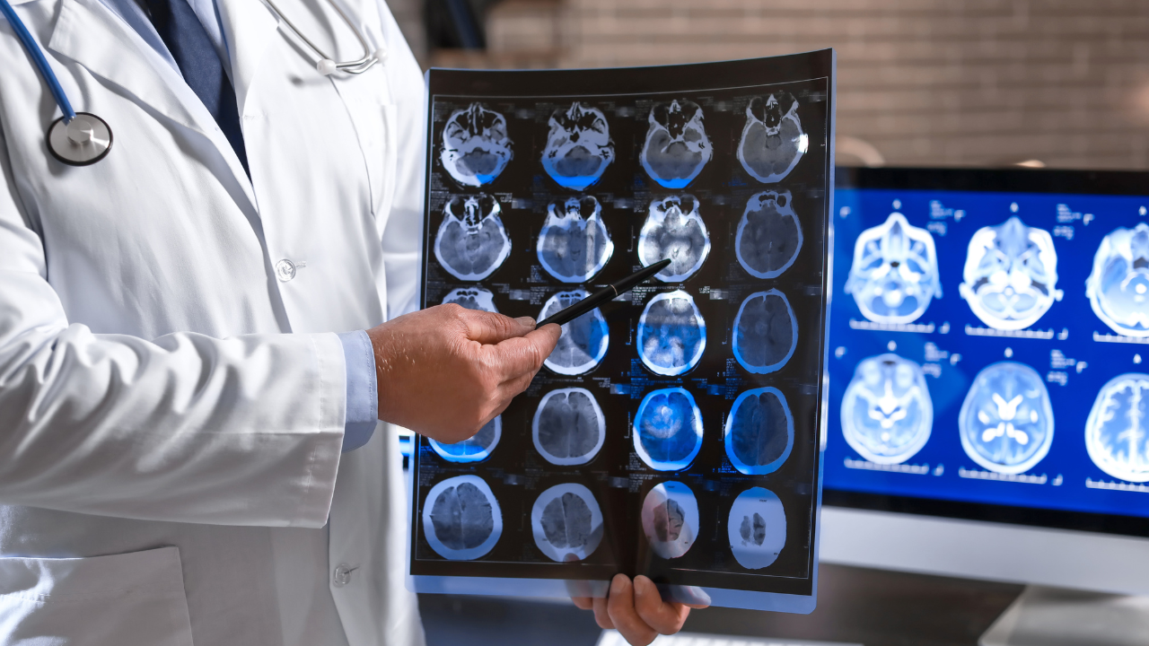 Infographic showing top neurologists in Panchkula, Chandigarh, and Zirakpur