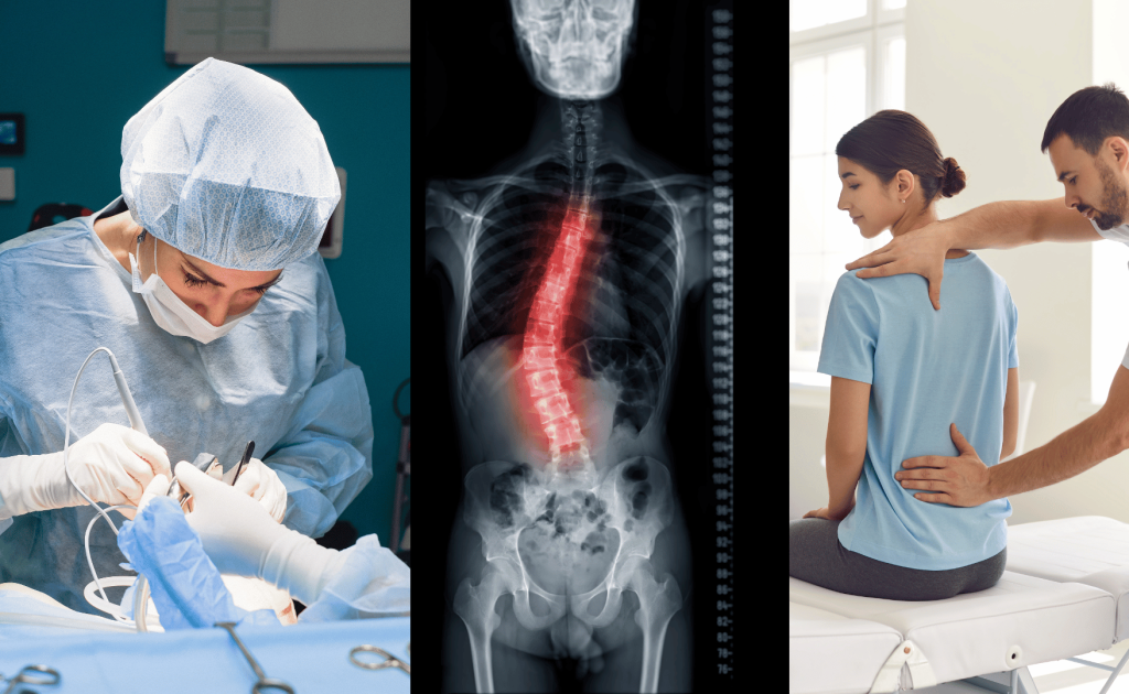 Spine surgery vs. physiotherapy comparison for back pain.