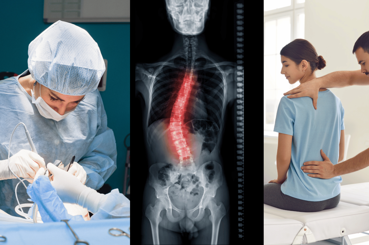 Spine surgery vs. Physiotherapy comparison for back pain.