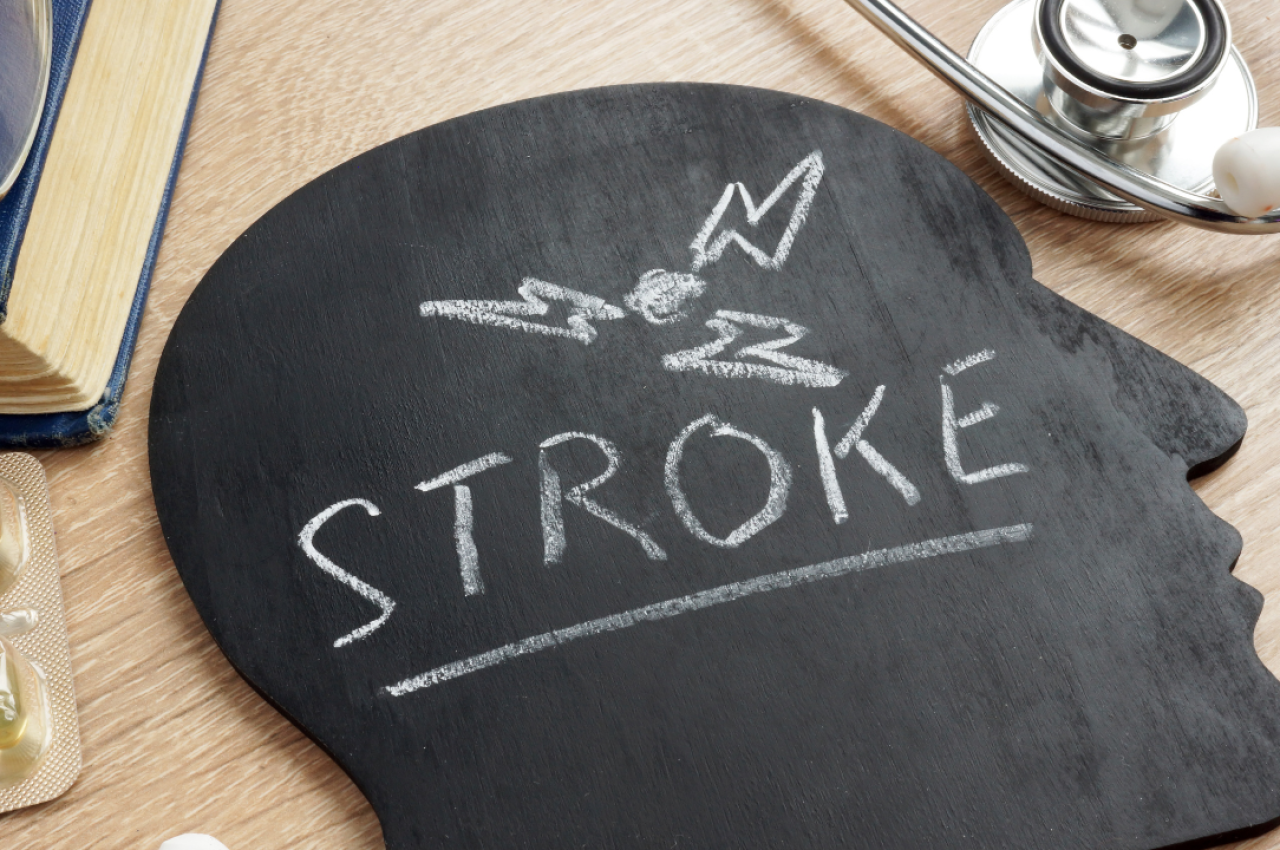 Medical illustration of stroke recovery and neurologist support