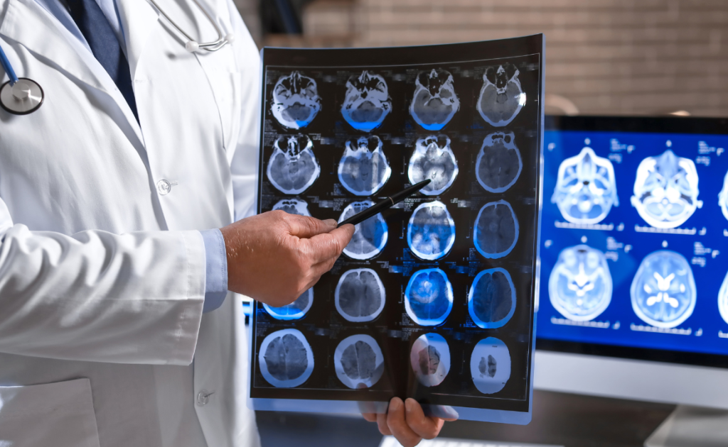 Infographic showing top neurologists in Panchkula, Chandigarh, and Zirakpur