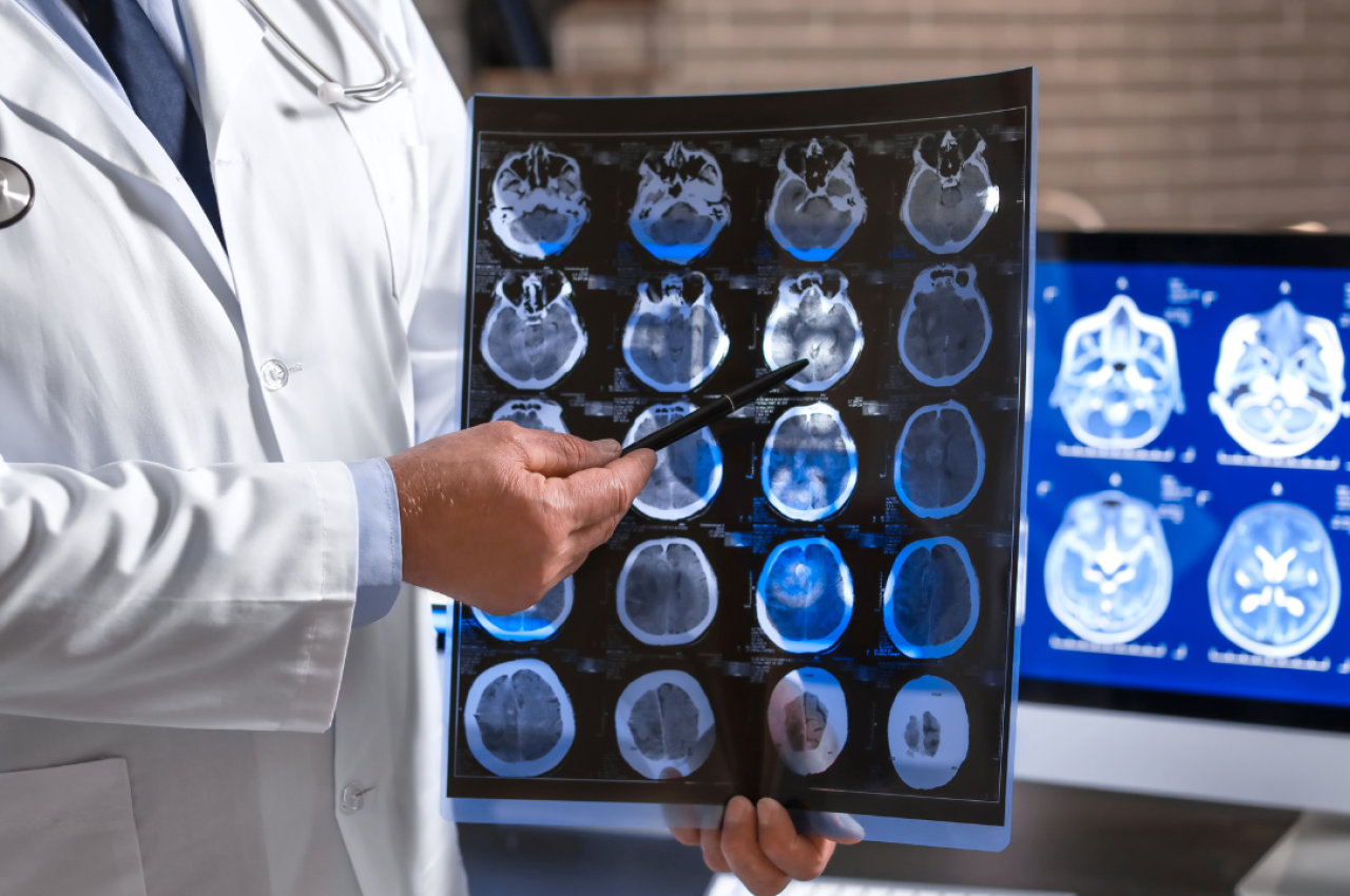 Infographic showing top neurologists in panchkula, chandigarh, and zirakpur