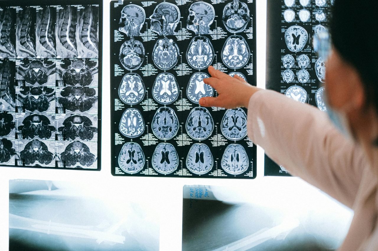 Illustration of a child with developmental delay and a neurologist examining early signs of pediatric neurological issues